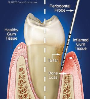 Dr Slots Periodontista