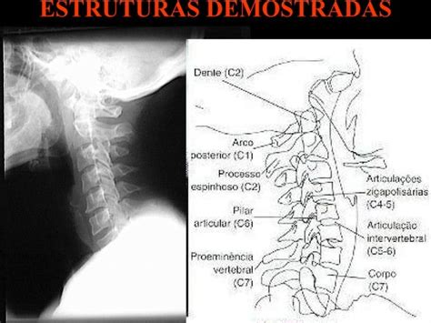 Fenda Ventral