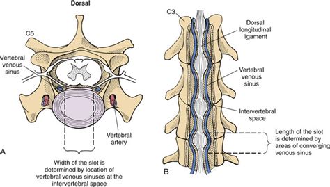 Slot Cervical Ventral