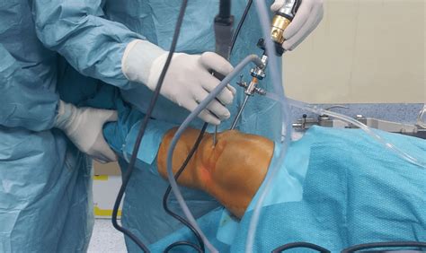 Ventral Slot Cirurgia De Recuperacao